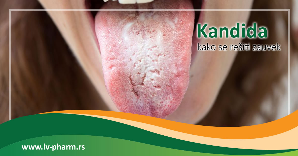 kako se resiti kandide zauvek